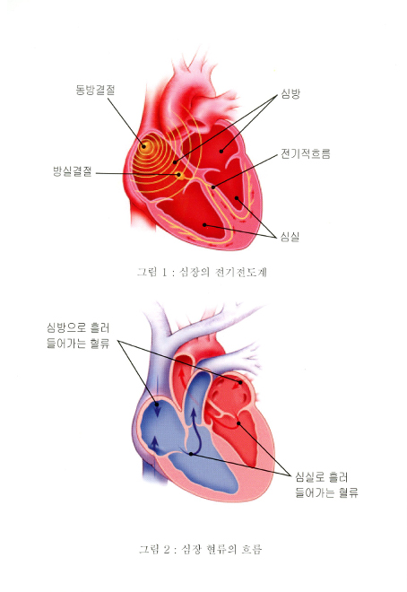 1.부정맥과 이식형제세동기
